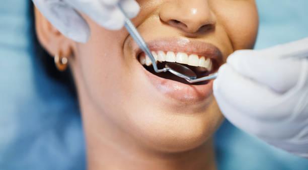 Best Emergency Tooth Extraction in Lenox, IA